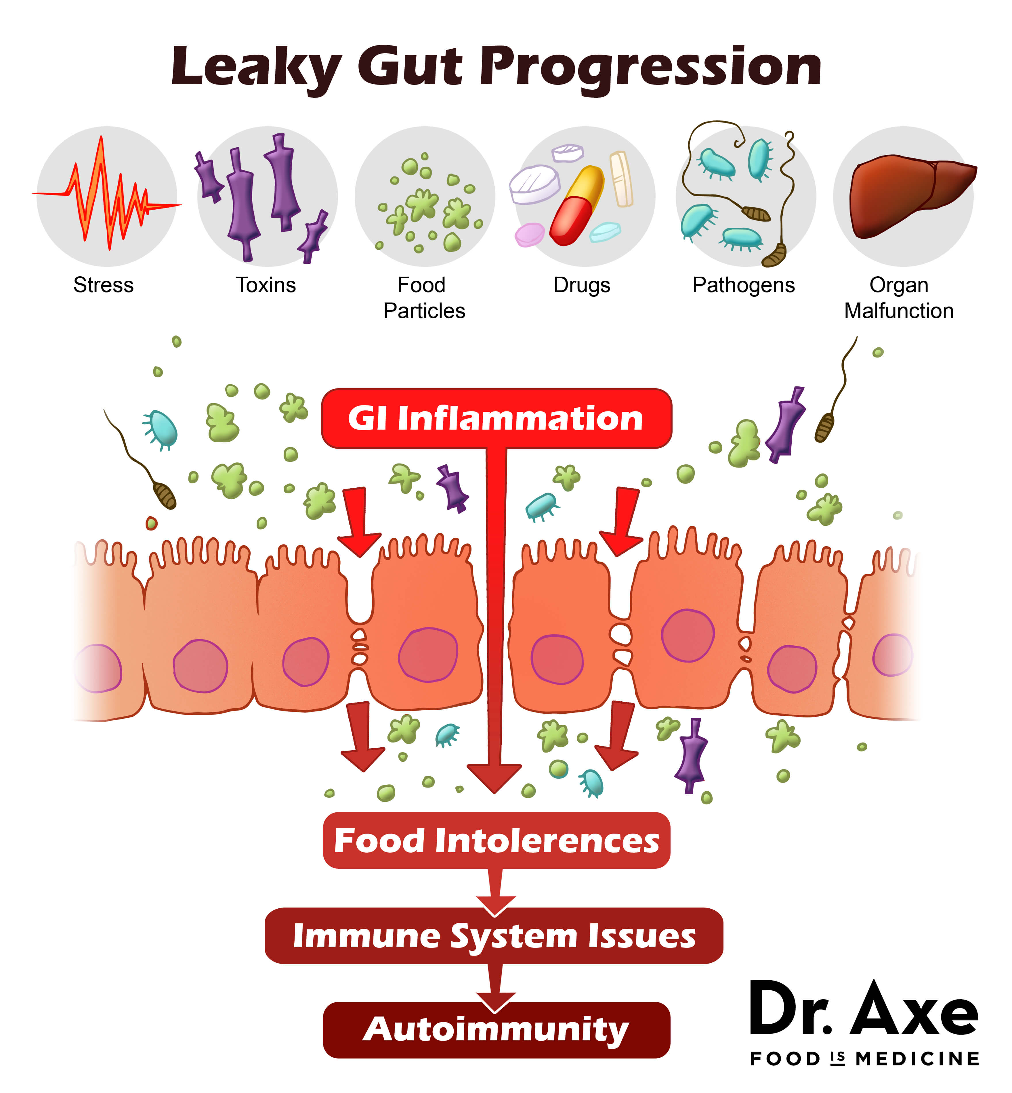 Healing from Within: Conquering Leaky Gut Syndrome