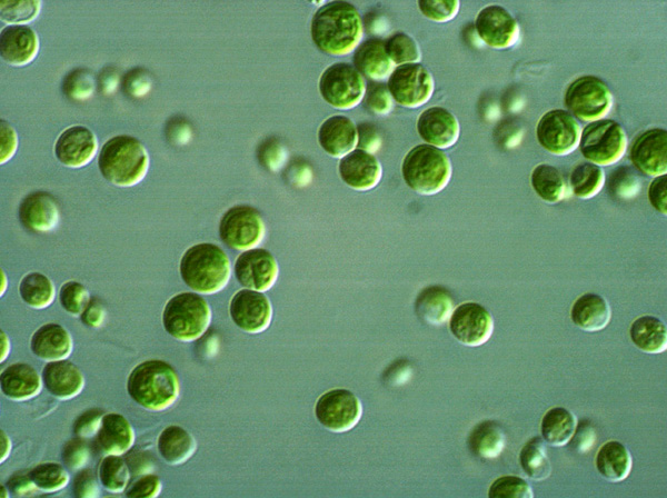 Chlorella: The Algae Powerhouse or Just a Pond Scum Fad?