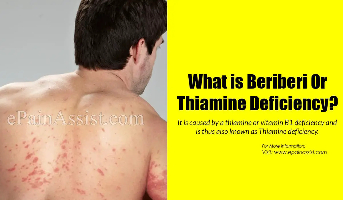 The Impact of Thiamine Deficiency: Symptoms and Health Consequences