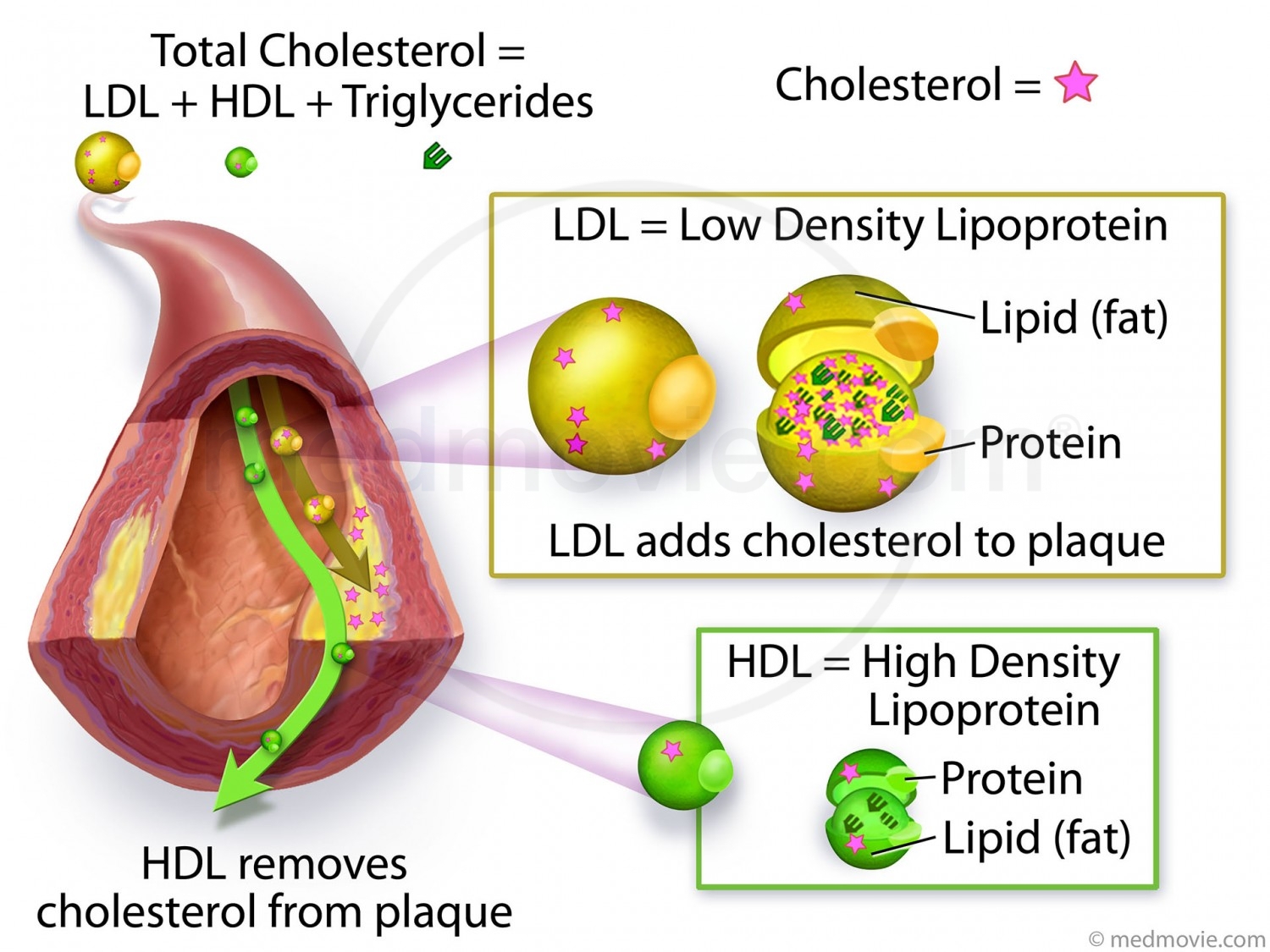 Managing Cholesterol: The Key to Heart Health